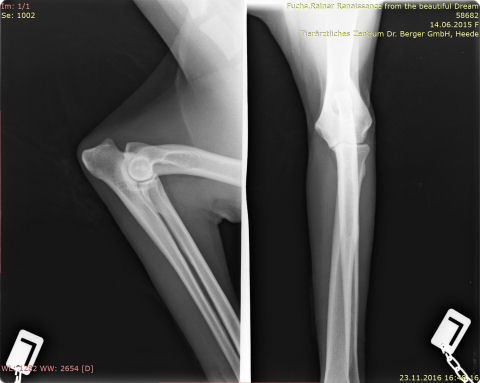 IMG-0004-00001-ellenbogen