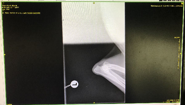 img_5246 (1)-Atlantid-ed-links